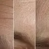 پکیج کامل تخصصی پوست