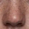 پکیج کامل تخصصی بینی