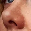 پکیج کامل تخصصی بینی