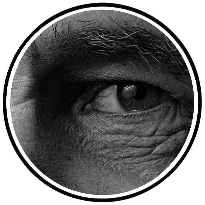 آموزش تخصصی پوست پیر