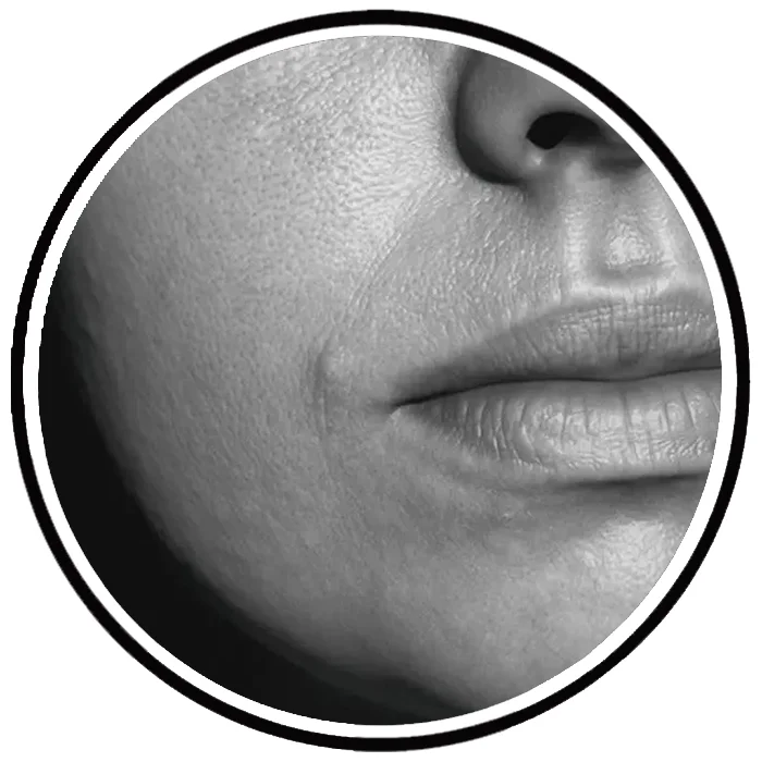 آموزش تخصصی پوست پرتقالی