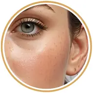 آموزش تناژ پوست روشن مایل به زرد