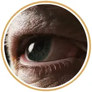 آموزش تخصصی چشم مدل4