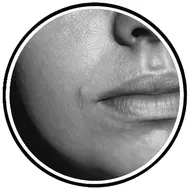 آموزش تخصصی پوست پرتقالی